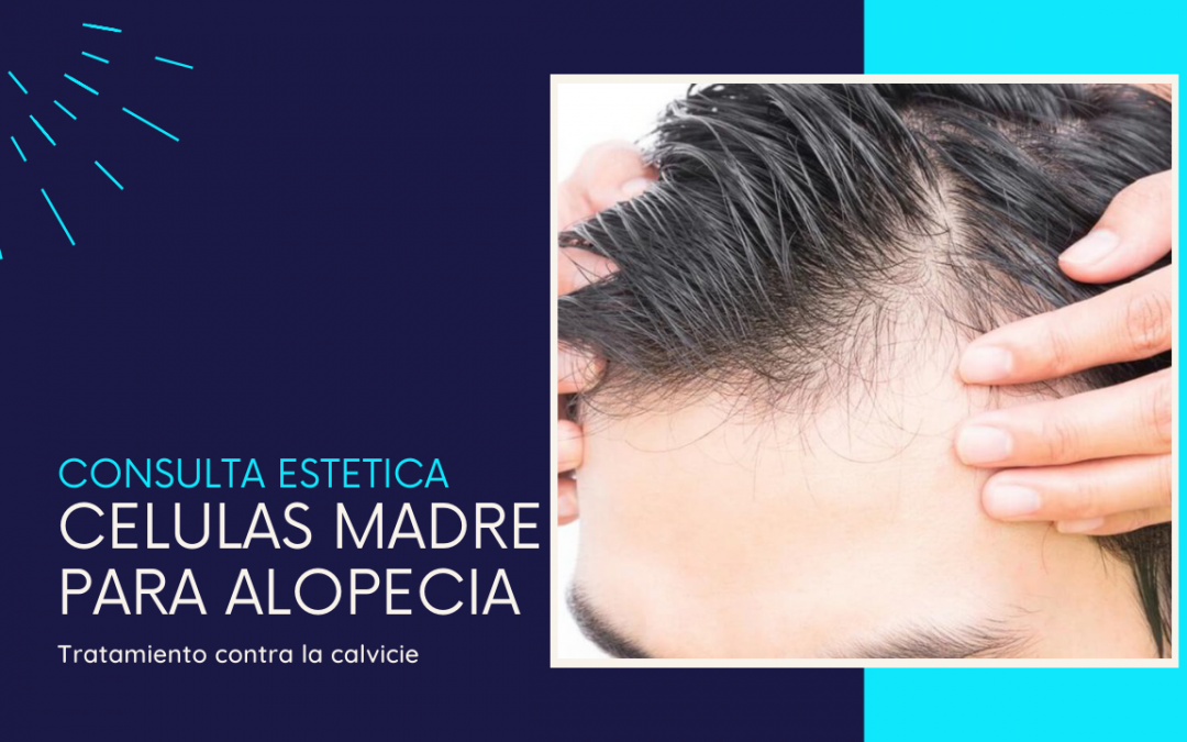 Terapia de células madre para alopecia